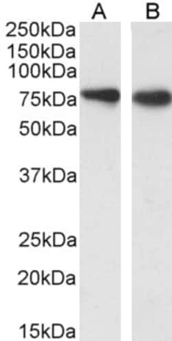 SLC26A6 Polyclonal Antibody, Invitrogen 100 &mu;g; Unconjugated:Antibodies,