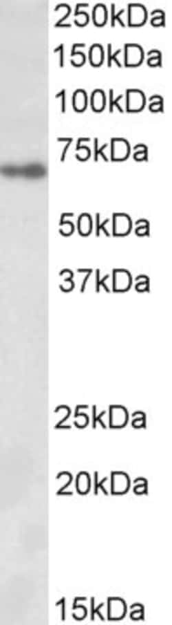 Invitrogen Zfp157 Polyclonal Antibody 100 &mu;g; Unconjugated:Antibodies,