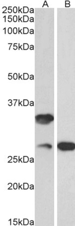 Invitrogen C16orf57 Polyclonal Antibody 100 &mu;g; Unconjugated:Antibodies,