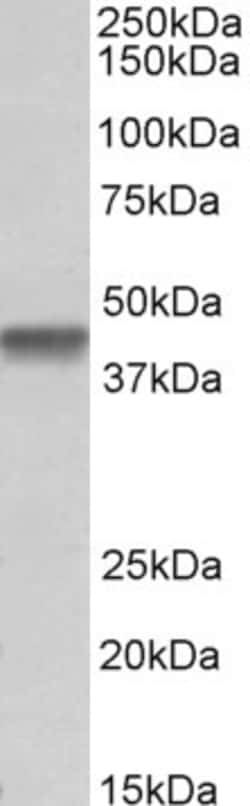 Invitrogen PTCD2 Polyclonal Antibody 100 &mu;g; Unconjugated:Antibodies,