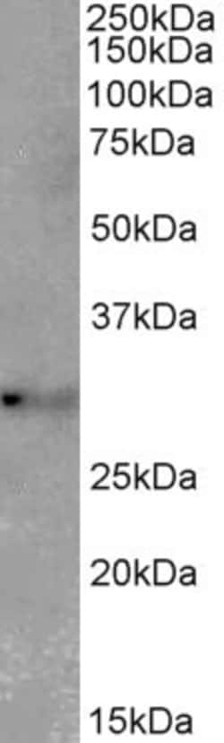 Invitrogen TSPAN14 Polyclonal Antibody 100 &mu;g | Buy Online | Invitrogen&trade; | Fisher Scientific