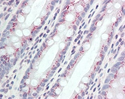 Invitrogen CCDC3 Polyclonal Antibody 100 &mu;g; Unconjugated:Antibodies,