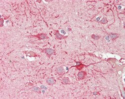 Invitrogen CROT Polyclonal Antibody 100 &mu;g; Unconjugated:Antibodies,