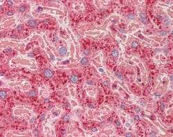 Invitrogen CROT Polyclonal Antibody 100 &mu;g; Unconjugated:Antibodies,