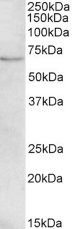 Invitrogen CROT Polyclonal Antibody 100 &mu;g; Unconjugated:Antibodies,