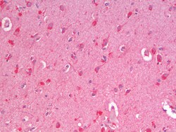 Invitrogen ZNRF1 Polyclonal Antibody 100 &mu;g; Unconjugated:Antibodies,