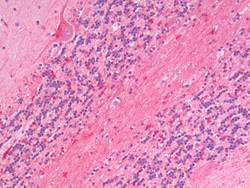 Invitrogen ZNRF1 Polyclonal Antibody 100 &mu;g; Unconjugated:Antibodies,