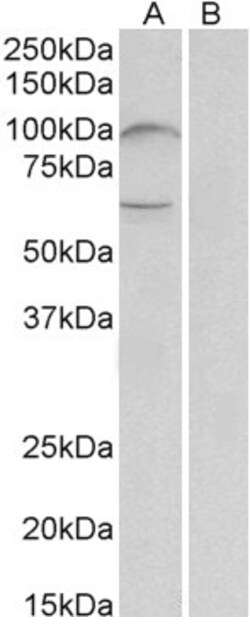 Invitrogen UNC5B Polyclonal Antibody 100 &mu;g; Unconjugated:Antibodies,