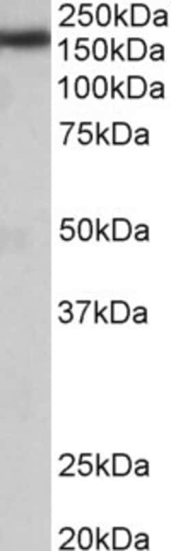 Invitrogen ZCCHC11 Polyclonal Antibody 100 &mu;g; Unconjugated:Antibodies,