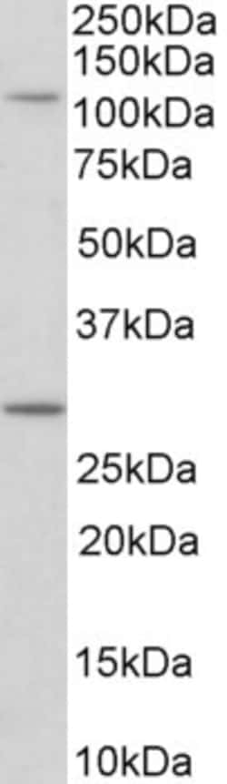 Invitrogen MYO1H Polyclonal Antibody 100 &mu;g; Unconjugated:Antibodies,