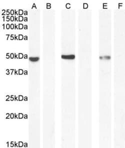 Invitrogen NAT8L Polyclonal Antibody 100 &mu;g; Unconjugated:Antibodies,