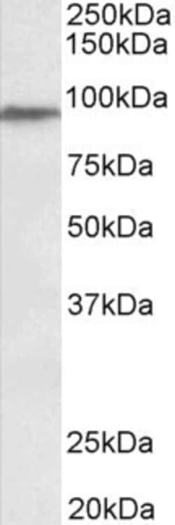 Invitrogen PTCHD3 Polyclonal Antibody 100 &mu;g; Unconjugated:Antibodies,