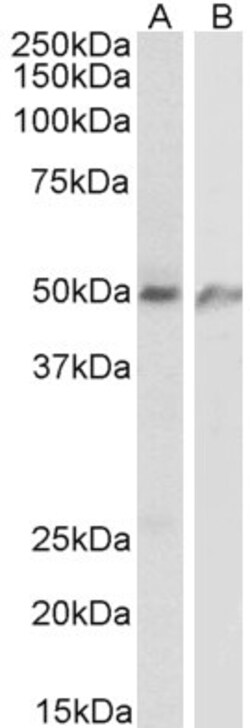 Invitrogen ECSCR Polyclonal Antibody 100 &mu;g; Unconjugated:Antibodies,