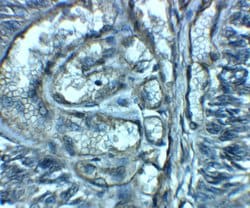 Invitrogen ENT2 Polyclonal Antibody 100 &mu;g; Unconjugated:Antibodies,