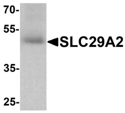 Invitrogen ENT2 Polyclonal Antibody 100 &mu;g; Unconjugated:Antibodies,