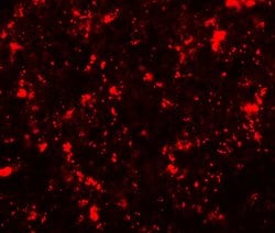 Invitrogen ME2 Polyclonal Antibody 100 &mu;g; Unconjugated:Antibodies,