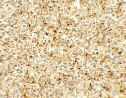 Invitrogen ME2 Polyclonal Antibody 100 &mu;g; Unconjugated:Antibodies,