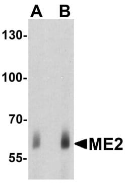 Invitrogen ME2 Polyclonal Antibody 100 &mu;g; Unconjugated:Antibodies,