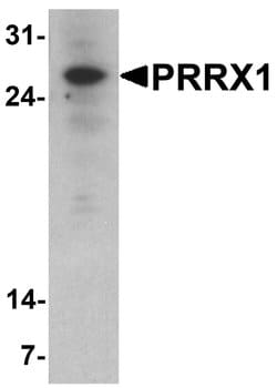 Invitrogen PRRX1 Polyclonal Antibody 100 &mu;g; Unconjugated:Antibodies,