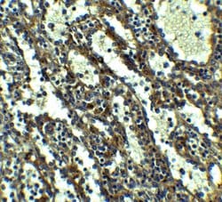 Invitrogen QSOX1 Polyclonal Antibody 100 &mu;g; Unconjugated:Antibodies,