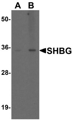 Invitrogen SHBG Polyclonal Antibody 100 μg; Unconjugated:Antibodies,