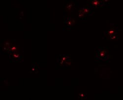 Invitrogen CD133 Polyclonal Antibody 100 &mu;g; Unconjugated:Antibodies,