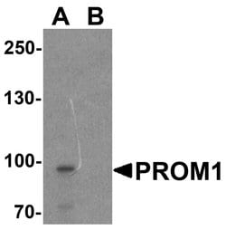 Invitrogen CD133 Polyclonal Antibody 100 &mu;g; Unconjugated:Antibodies,