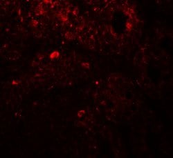 Invitrogen TRIP12 Polyclonal Antibody 100 &mu;g; Unconjugated:Antibodies,