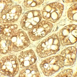 Invitrogen TRIP12 Polyclonal Antibody 100 &mu;g; Unconjugated:Antibodies,