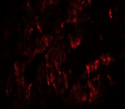 Invitrogen WAPL Polyclonal Antibody 100 &mu;g | Buy Online | Invitrogen&trade; | Fisher Scientific