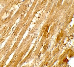 Invitrogen WAPL Polyclonal Antibody 100 &mu;g | Buy Online | Invitrogen&trade; | Fisher Scientific