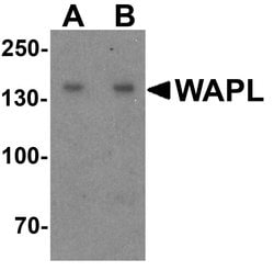 Invitrogen WAPL Polyclonal Antibody 100 &mu;g | Buy Online | Invitrogen&trade; | Fisher Scientific