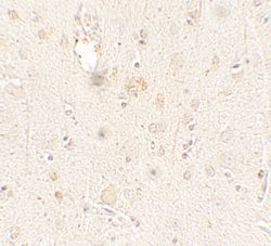 Invitrogen ULK3 Polyclonal Antibody 100 &mu;g; Unconjugated:Antibodies,