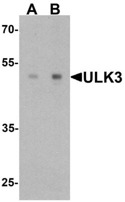 Invitrogen ULK3 Polyclonal Antibody 100 &mu;g; Unconjugated:Antibodies,