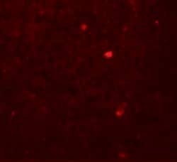 Invitrogen LAMTOR2 Polyclonal Antibody 100 &mu;g; Unconjugated:Antibodies,