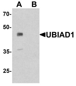 Invitrogen UBIAD1 Polyclonal Antibody 100 &mu;g; Unconjugated:Antibodies,