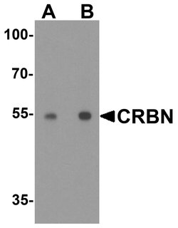 Invitrogen CRBN Polyclonal Antibody 100 &mu;g; Unconjugated:Antibodies,