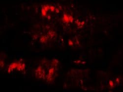 Invitrogen SLC29A3 Polyclonal Antibody 100 &mu;g; Unconjugated:Antibodies,