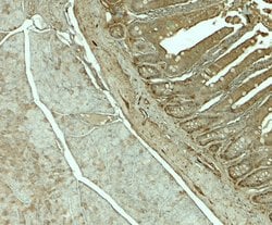 Invitrogen SLC29A3 Polyclonal Antibody 100 &mu;g; Unconjugated:Antibodies,