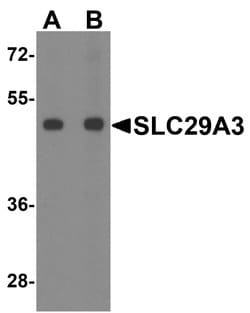 Invitrogen SLC29A3 Polyclonal Antibody 100 &mu;g; Unconjugated:Antibodies,