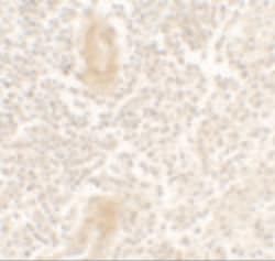 Invitrogen IL1F10 Polyclonal Antibody 100 &mu;g; Unconjugated:Antibodies,