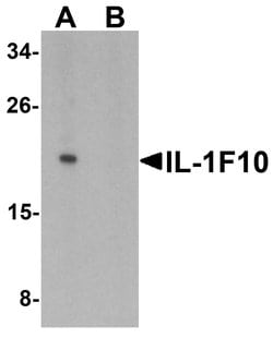 Invitrogen IL1F10 Polyclonal Antibody 100 &mu;g; Unconjugated:Antibodies,