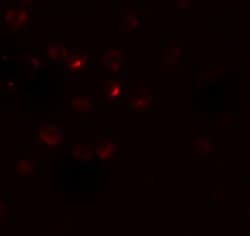 Invitrogen RSPO3 Polyclonal Antibody 100 &mu;g; Unconjugated:Antibodies,