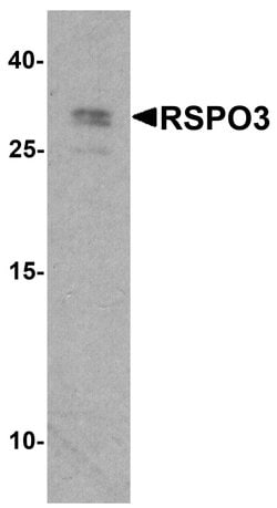 Invitrogen RSPO3 Polyclonal Antibody 100 &mu;g; Unconjugated:Antibodies,