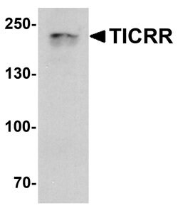 Invitrogen Treslin Polyclonal Antibody 100 &mu;g; Unconjugated:Antibodies,