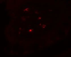 Invitrogen CTHRC1 Polyclonal Antibody 100 &mu;g; Unconjugated:Antibodies,