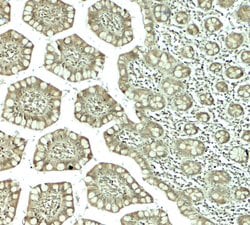 Invitrogen CTHRC1 Polyclonal Antibody 100 &mu;g; Unconjugated:Antibodies,