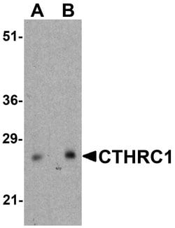 Invitrogen CTHRC1 Polyclonal Antibody 100 &mu;g; Unconjugated:Antibodies,