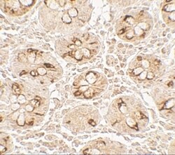 Invitrogen TMIGD2 Polyclonal Antibody 100 &mu;g | Buy Online | Invitrogen&trade; | Fisher Scientific