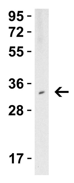 Invitrogen TMIGD2 Polyclonal Antibody 100 &mu;g | Buy Online | Invitrogen&trade; | Fisher Scientific